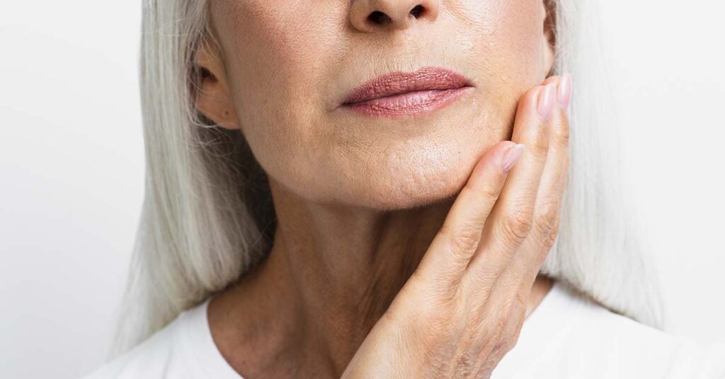 Laser Fotona Spectro: como funciona o rejuvenescimento 4D, acne e manchas